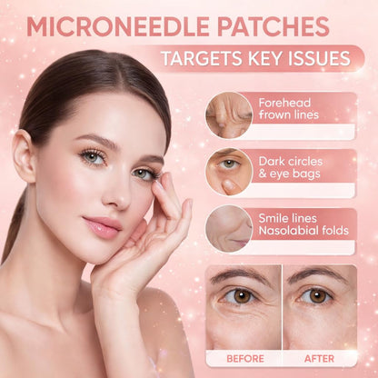 Micro Eye Patches – under Eye Patch with Hyaluronic Acid & Collagen for Dark Circles, Smooth Application Forehead & Smile Line Patches for Women (2)